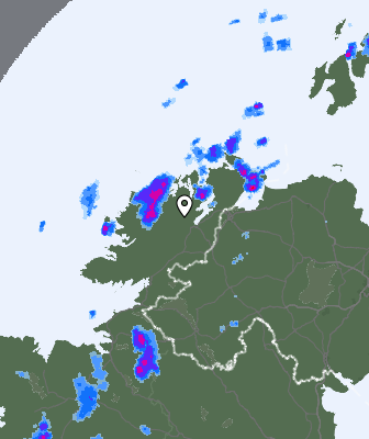 Radar