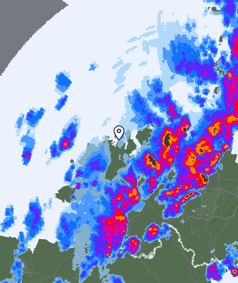 Radar