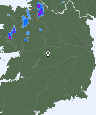 Radar
