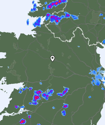 Radar