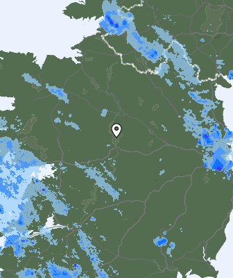 Radar