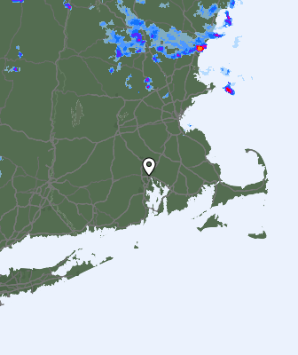 Radar
