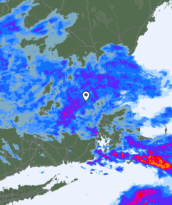 Radar