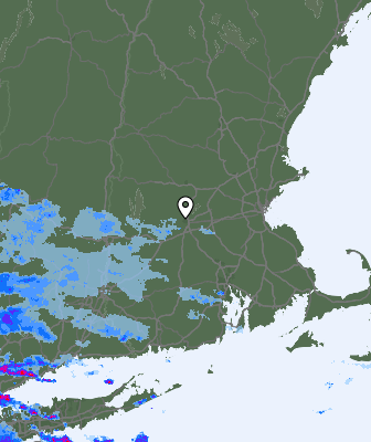 Radar