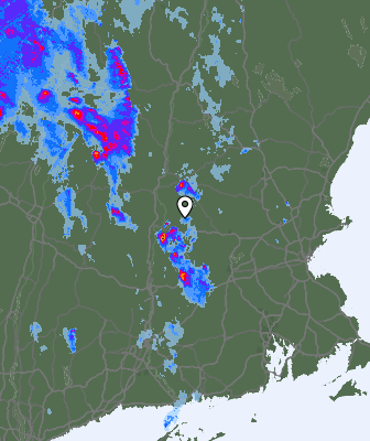 Radar