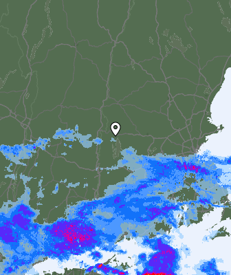 Radar