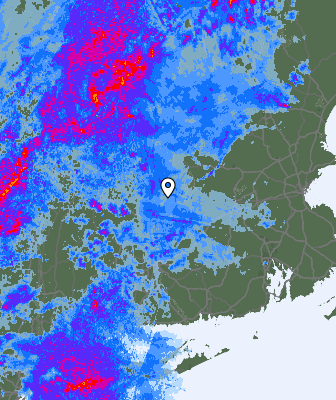 Radar