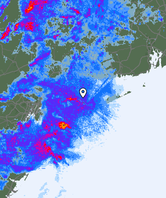 Radar