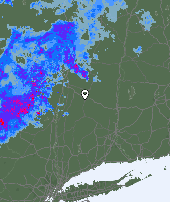 Radar