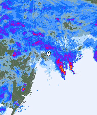 Radar