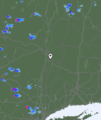 Radar
