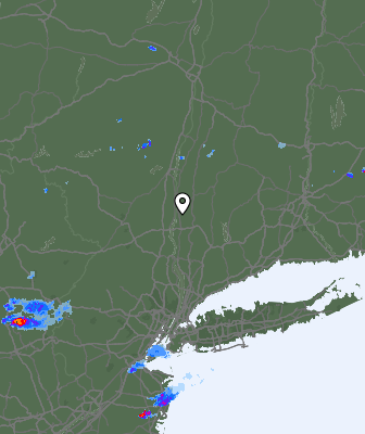 Radar