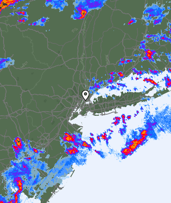 Radar