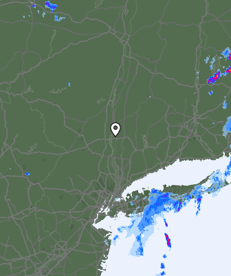 Radar