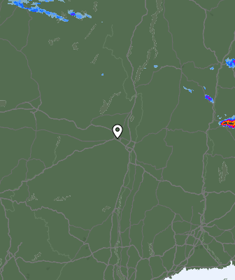 Radar
