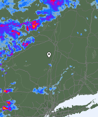 Radar