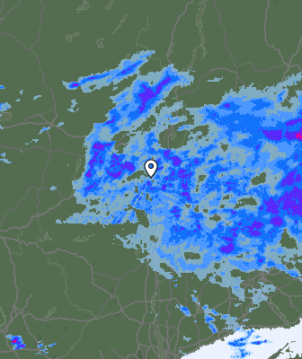 Radar