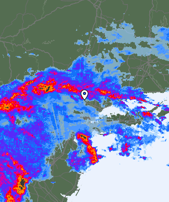 Radar