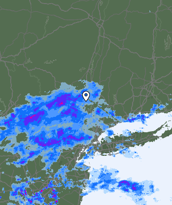 Radar