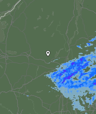 Radar