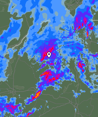 Radar