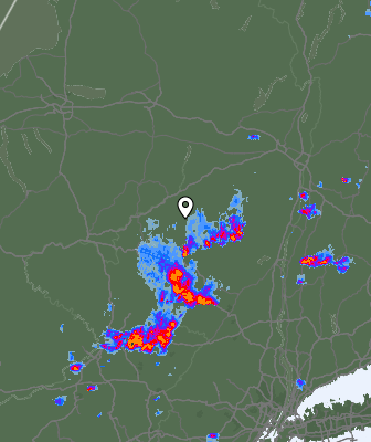 Radar
