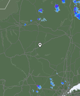 Radar