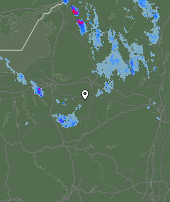 Radar
