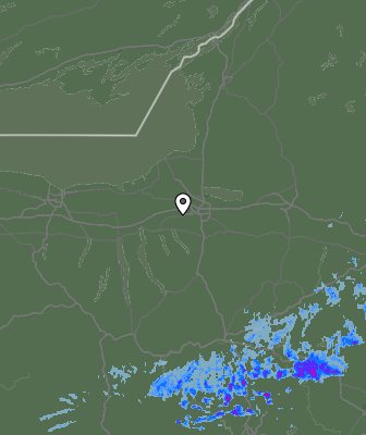 Radar
