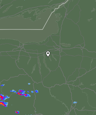 Radar
