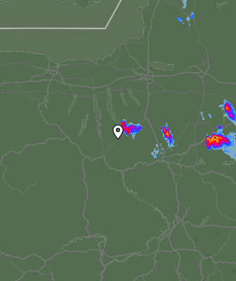 Radar