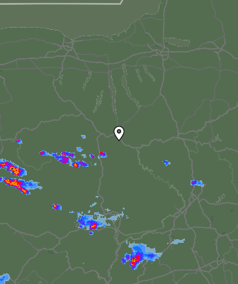 Radar