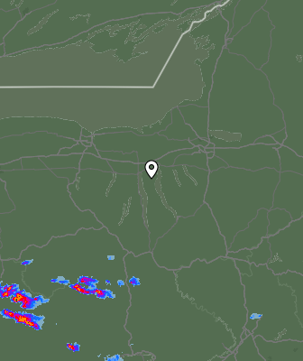 Radar