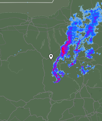 Radar