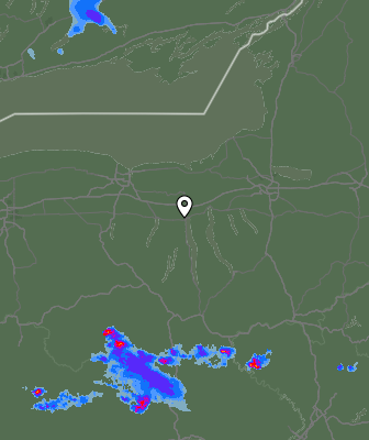 Radar