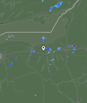 Radar