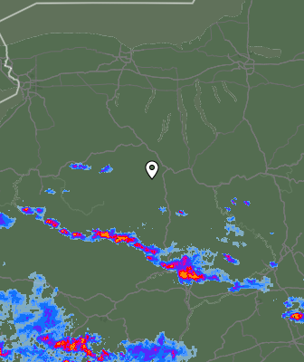 Radar