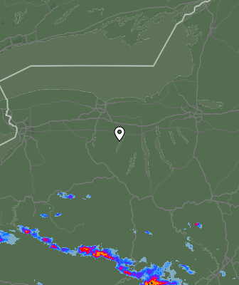 Radar
