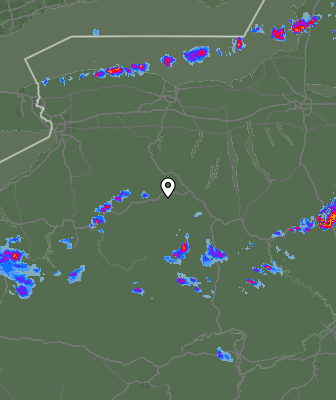 Radar