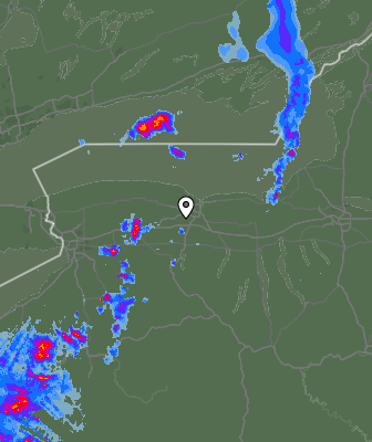 Radar