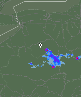 Radar