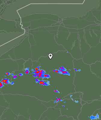 Radar