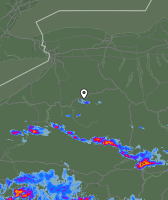 Radar