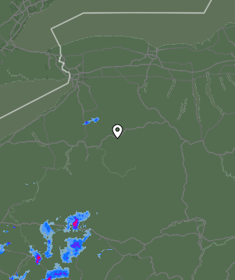 Radar