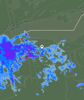 Radar