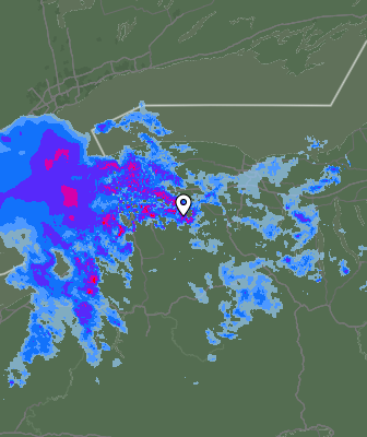 Radar