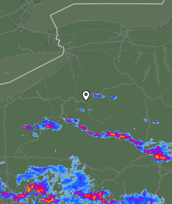 Radar