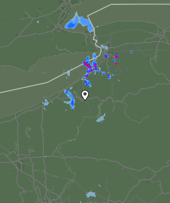 Radar