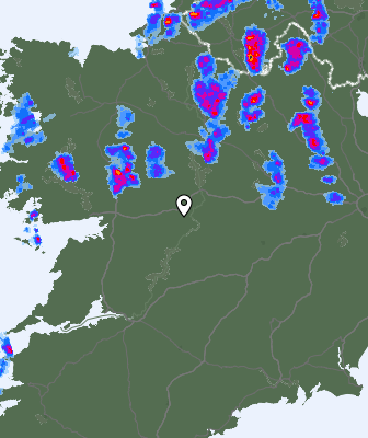 Radar