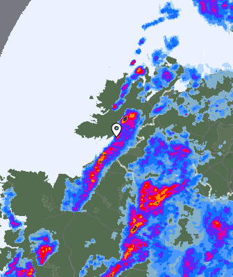Radar